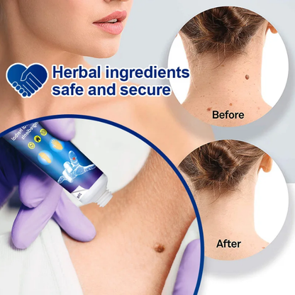 Sumifun Wart Remover Ointment
